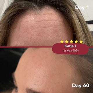 Collagen Before/After Images for Zooki Collagen