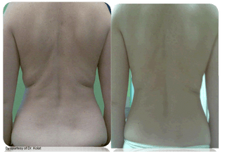 Guna Mesotherapy Before & After Pictures